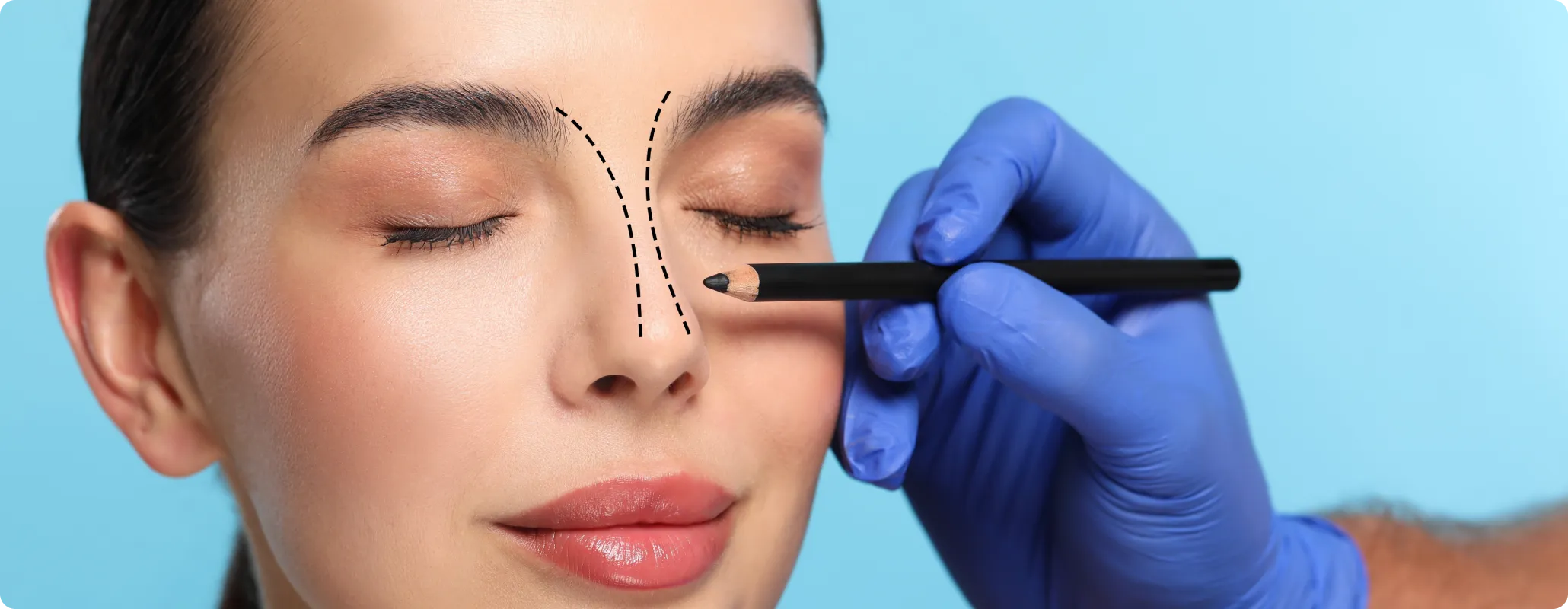 Blog the importance of marketing for cosmetic surgeons