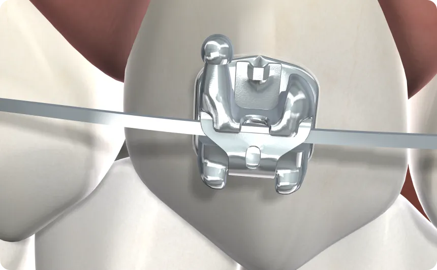 Stemodontics 3d image rendering 2