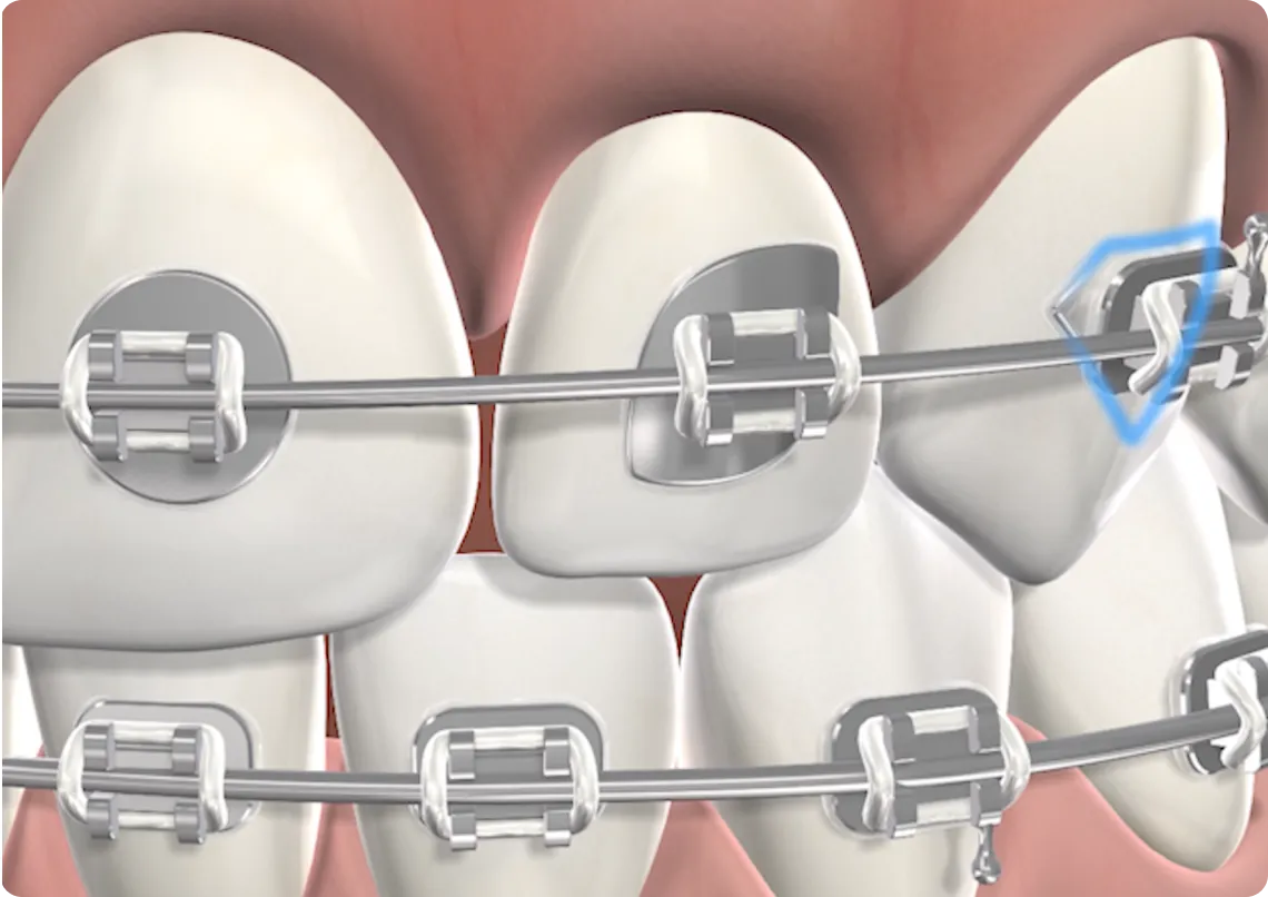 Stemodontics 3d image rendering